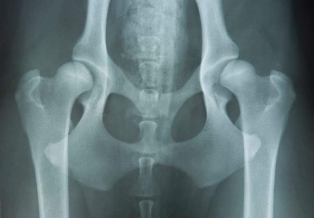 x-ray showing hip dysplasia in dog
